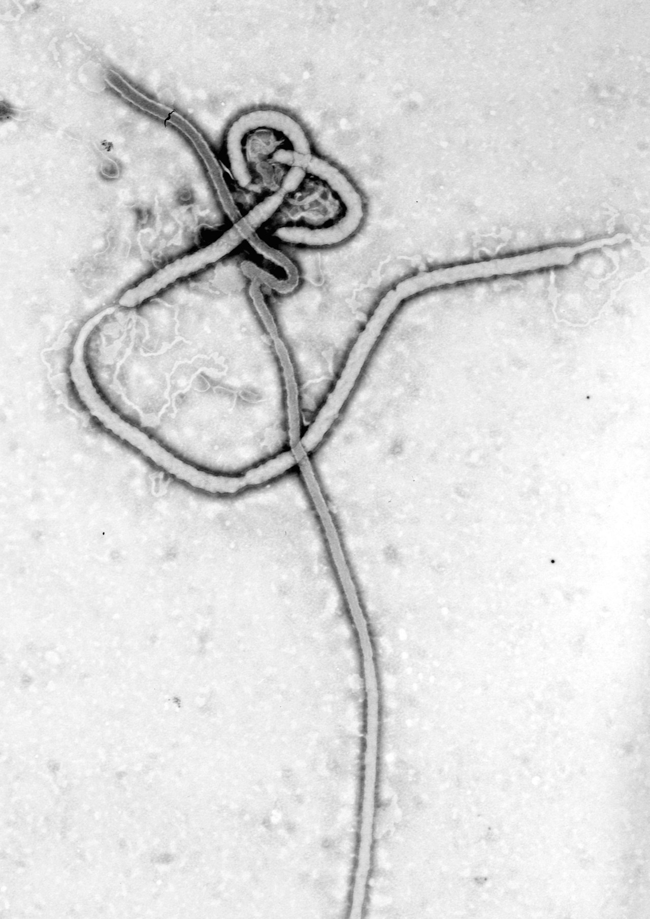 Elektronenmikroskopische Aufnahme des Ebola-Virus, aufgenommen von Dr. Frederick A. Murphy am US-amerikanischen Centers for Disease Control and Prevention.